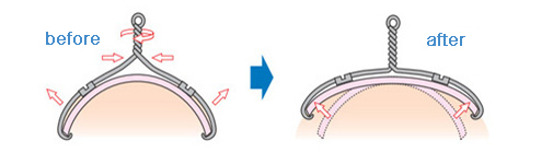 Ingrown Nail Correction